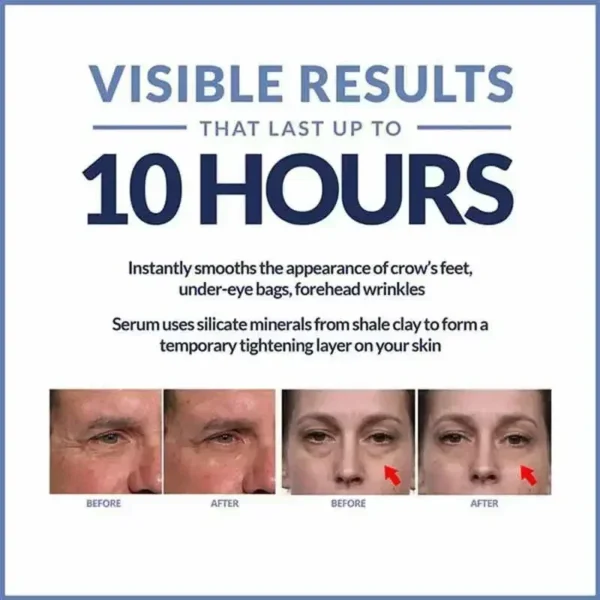 Instant Eye Cream For Anti Aging Dark Circles Bags Puffiness Great Under Eye Skin Face Tightening Eye Lift Treatment Care A - Image 5