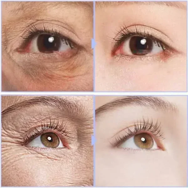 Instant Eye Cream For Anti Aging Dark Circles Bags Puffiness Great Under Eye Skin Face Tightening Eye Lift Treatment Care A - Image 3